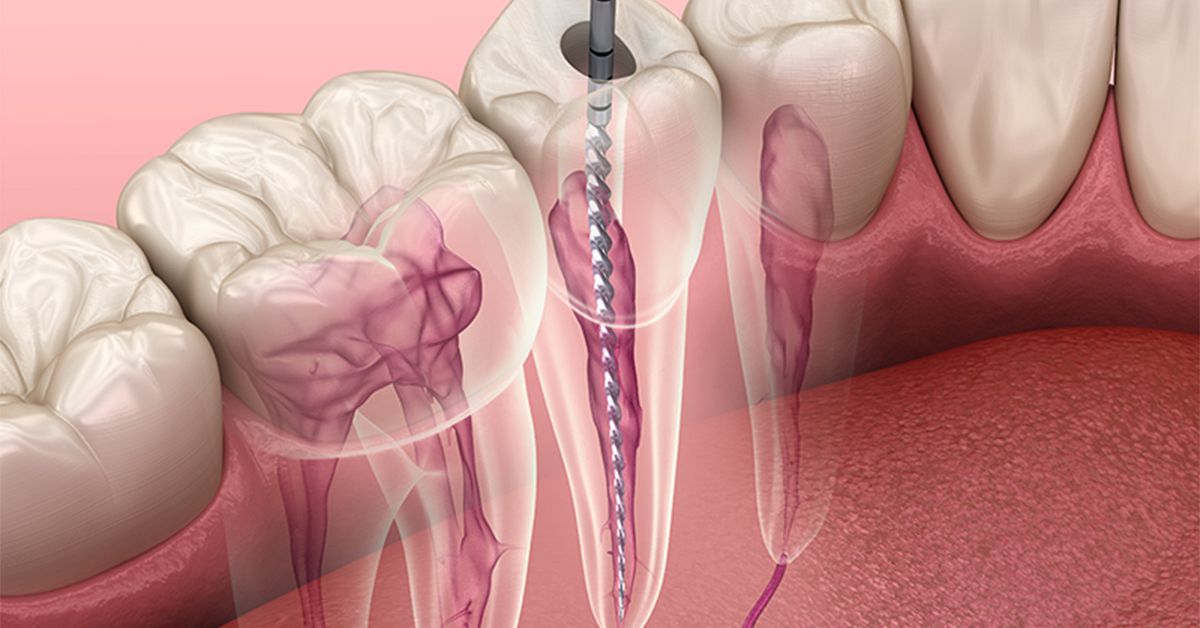 Endodontia